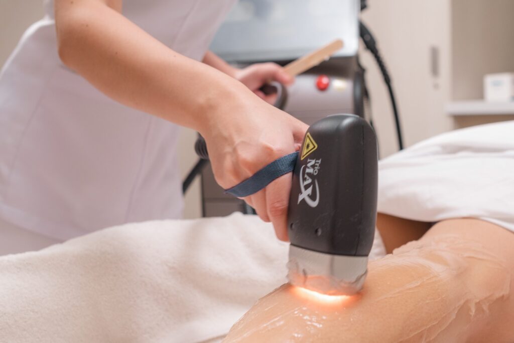At What Age Can Young Girls Get Laser Hair Removal?