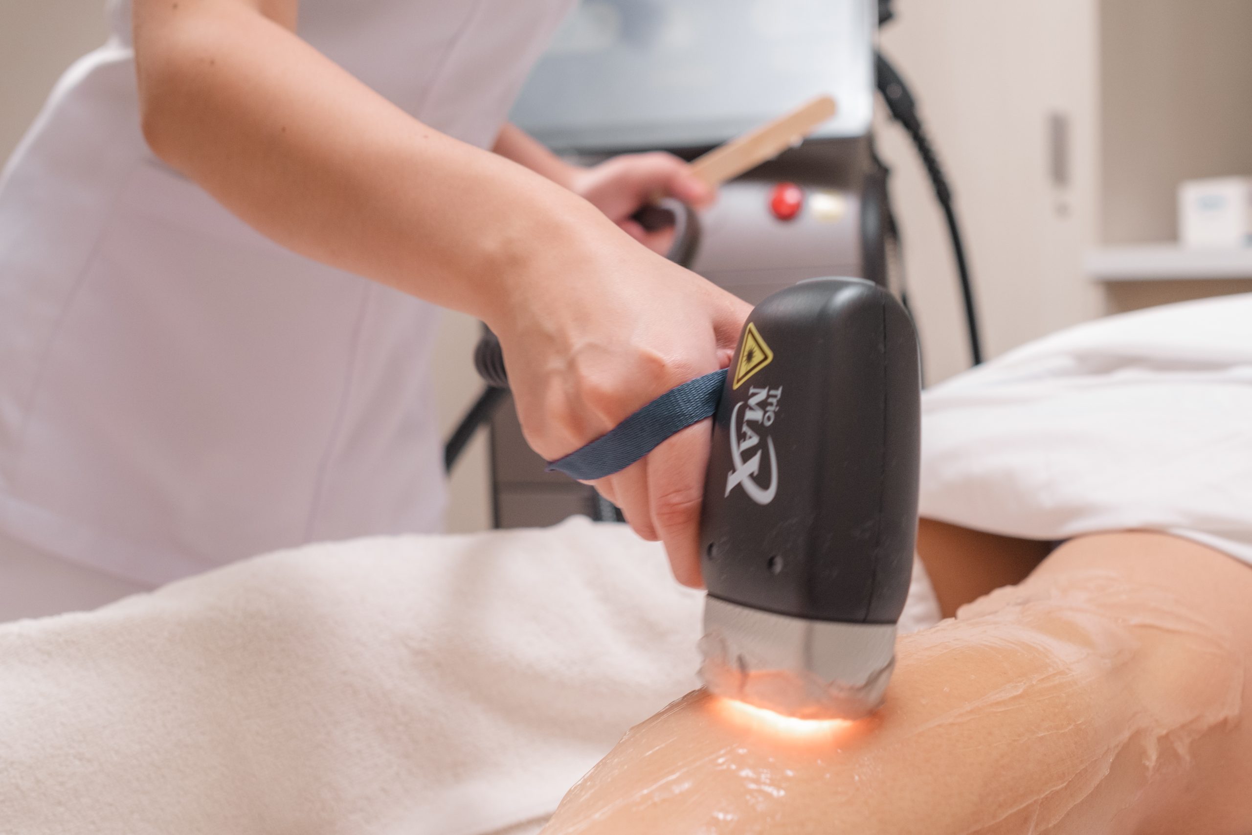 At What Age Can Young Girls Get Laser Hair Removal?