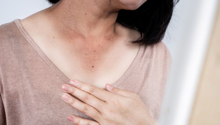 Sun Damage Solutions Every Zillennial Should Know