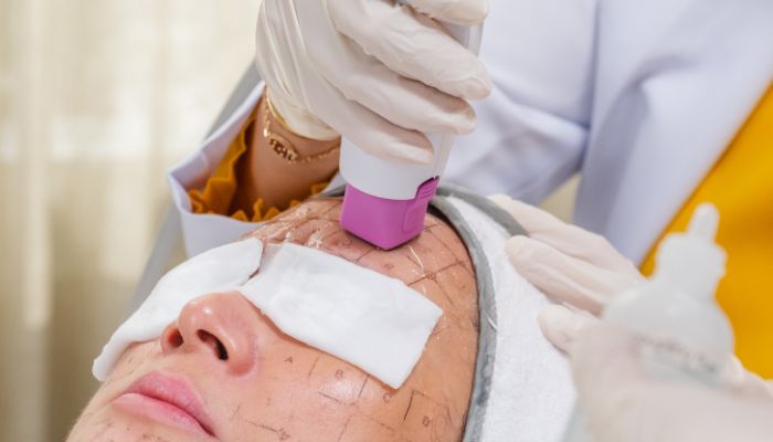 Tighten Up With Thermage’s Skin Magic