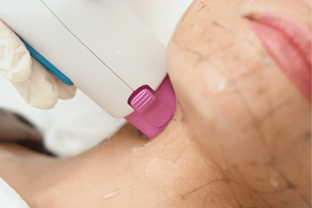 Exploring 6 Non-Surgical Options for a Youthful, Natural Look