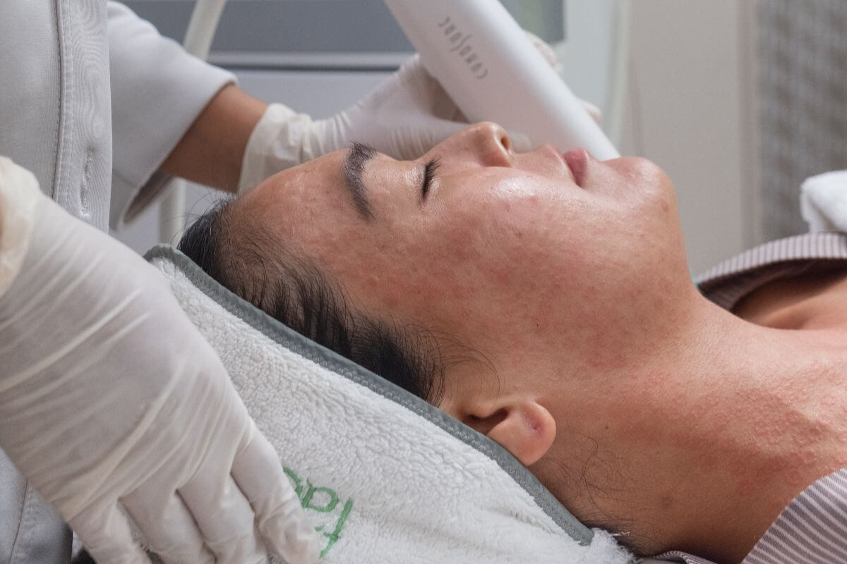 Professional skin rejuvenation for a natural glow