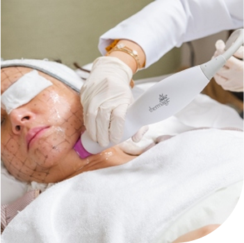 Thermage FLX Overview 3