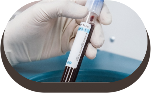 PRP Therapy Benefits