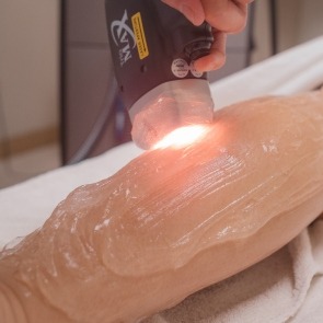 LaserLight Hair Removal