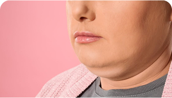 Dealing with double chin? Here are 3 ways to tone, tighten the chin and jaw area