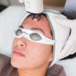 Can Laser Therapy Help Old Scars Fade?