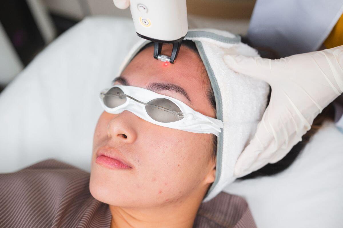 Can Laser Therapy Help Old Scars Fade?