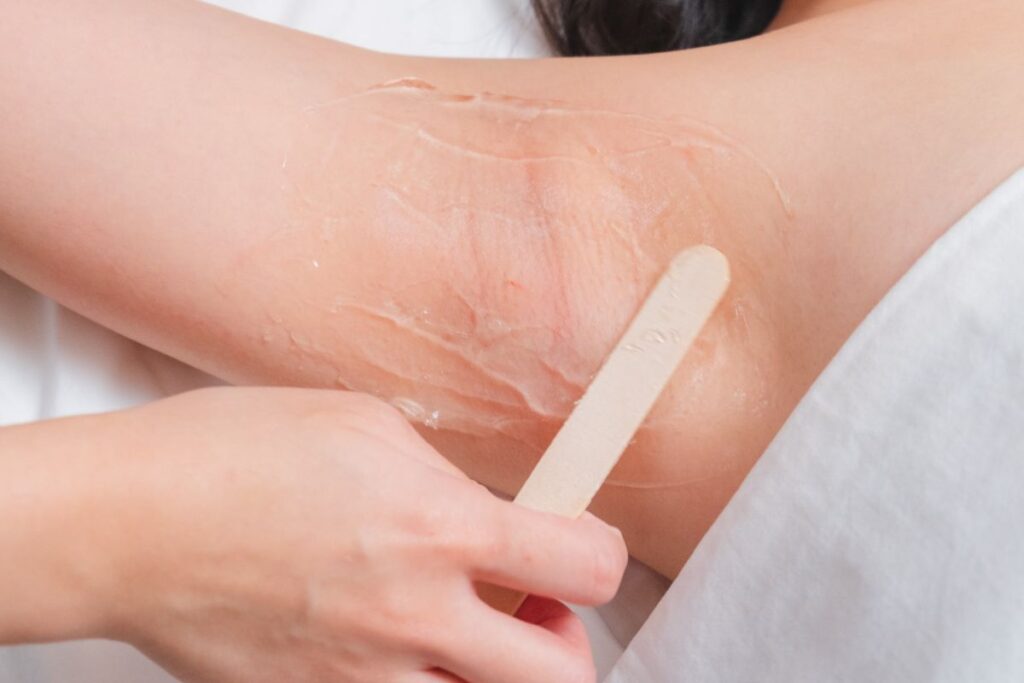 PCOS and Facial Hair: What to Know Before Choosing Laser Hair Removal