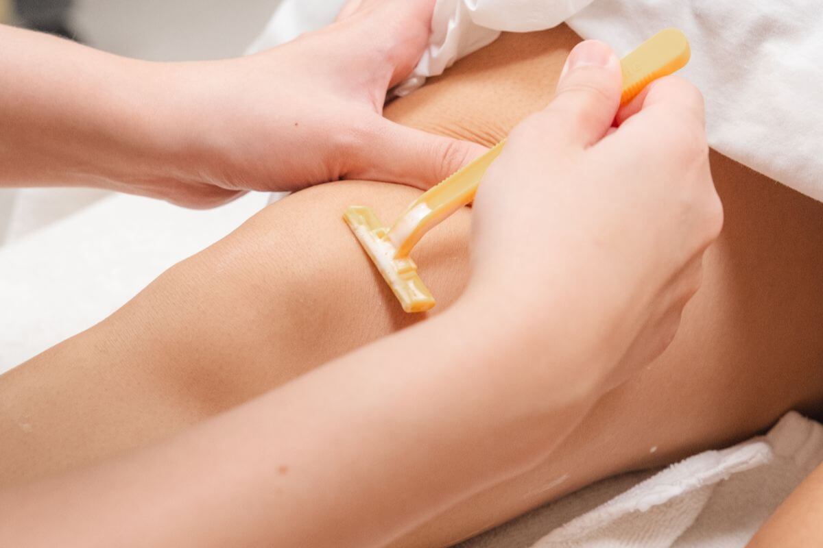 Understanding PCOS and Laser Hair Removal