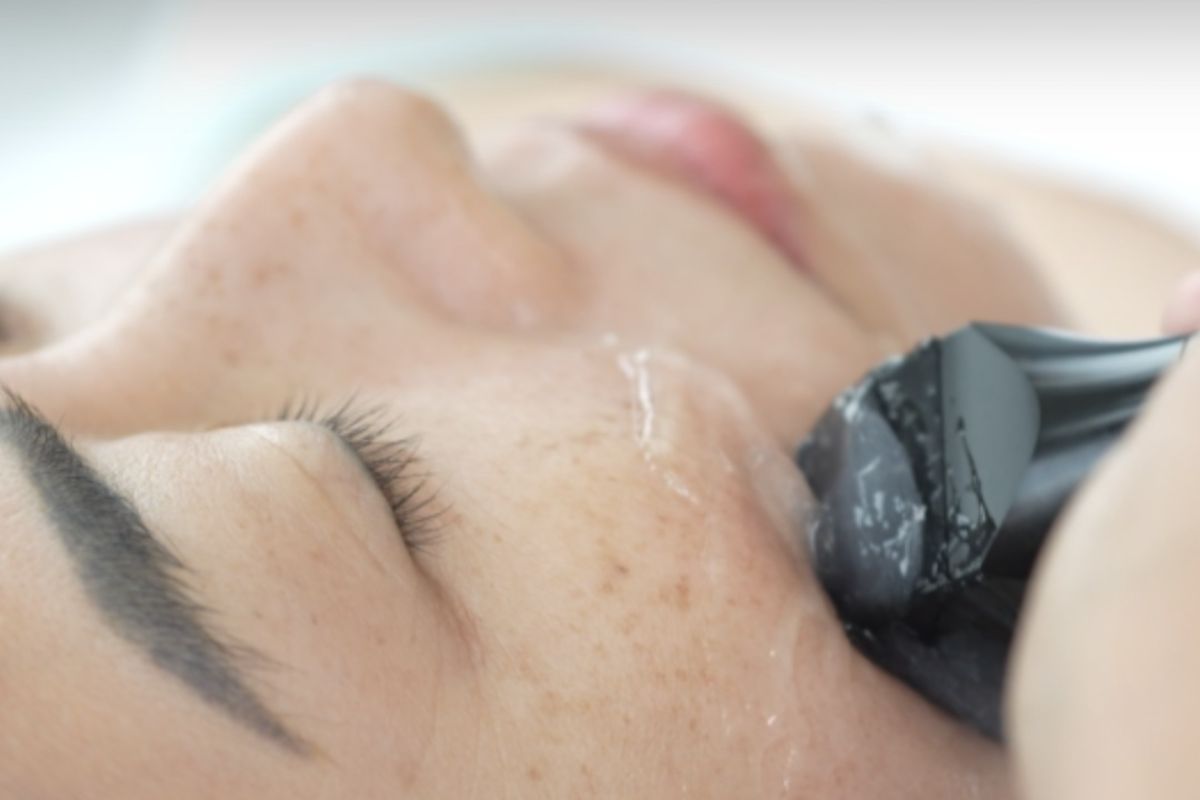 What Deep Acne Treatment is Available at Facial Care Centre