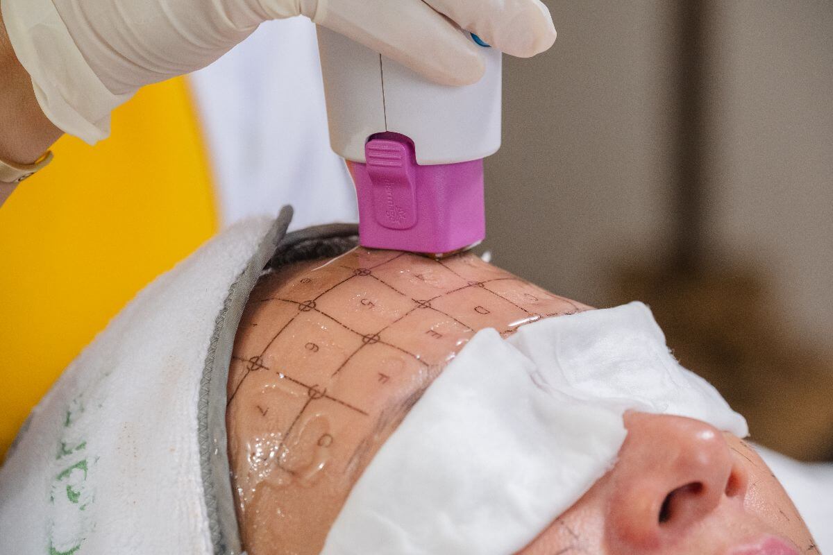Why You Need a Different Acne Treatment if You Have Hormonal Imbalances