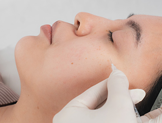 Melasma Solutions - Best For