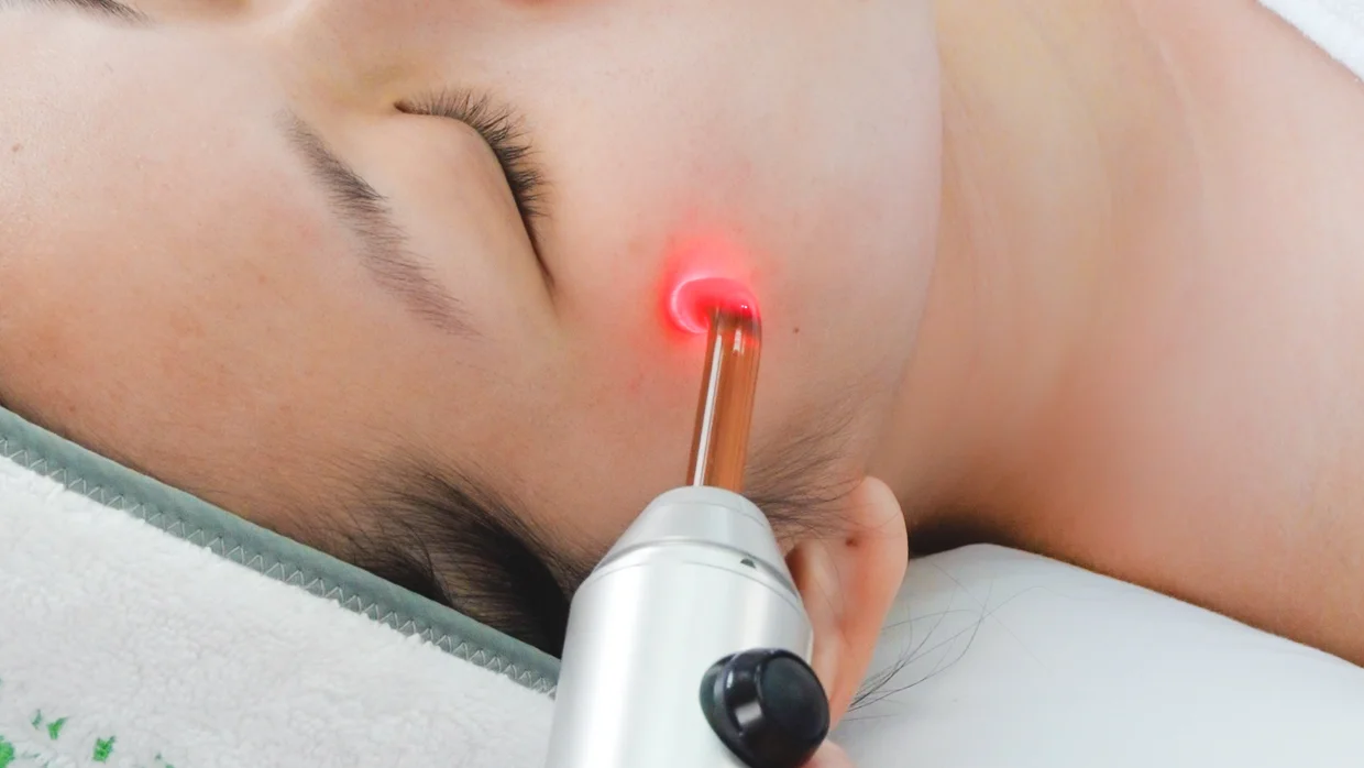 Advanced Lasertone - Expected Results